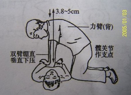 密闭车厢点蚊香睡觉晕厥 父亲2分钟心肺复苏救